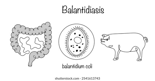 Balantidiasis. An infection in which a person becomes infected with the ciliates Balantidium coli, which enter the patient's body from infected pigs. Medical vector on white background.