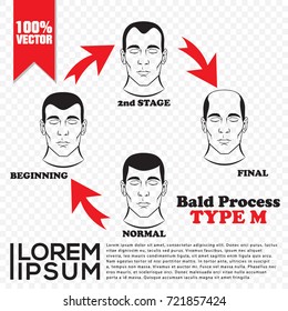 Bald Process Type M Vector