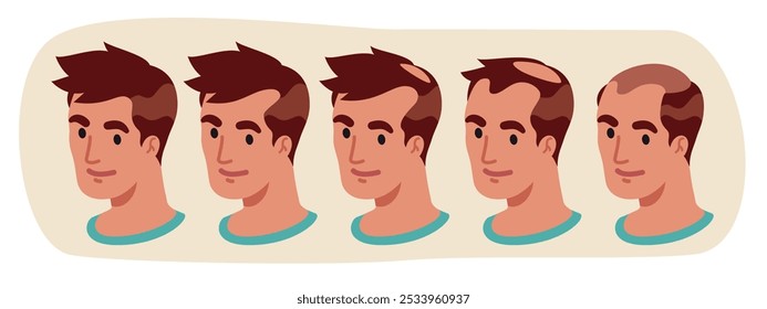 Palcos de careca na cabeça do jovem. Pessoa do sexo masculino com o couro cabeludo careca sem pelos. Perda de cabelo problema de saúde passos coleção. Calvície humana, alopecia, conjunto de ilustração de vetor da escala de Hamilton-Norwood