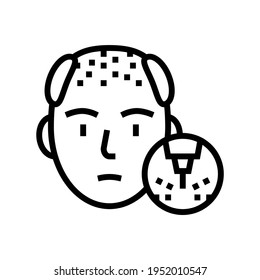 baldness disease line icon vector. baldness disease sign. isolated contour symbol black illustration