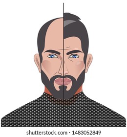 Baldness in man, male with bald head, before and after hair transplantation, male alopecia, plastic surgery, treatment. Vector illustration