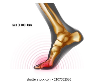 Ball of foot pain bones skeleton realistic anatomy illustration