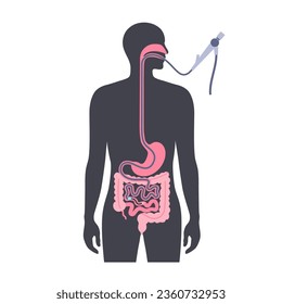 Balloon assisted enteroscopy. Visualization of the small intestine nonsurgical procedure. Gastrointestinal tract exam. Biopsy, polyp removal, bleeding therapy or stent placement vector illustration