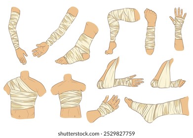 Bandaged body parts mega set elements in flat graphic design. Collection objects of injured legs, arms, palms, back, chest, torso, ankle, knees with bandage applying or gypsum. Vector illustration.