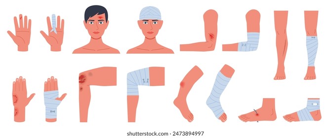 Bandaged body parts. Open wounds, different injuries, abrasions and bruises, arms, head and legs, medical allowance, traumatology and rehabilitation, cartoon flat isolated nowaday vector set