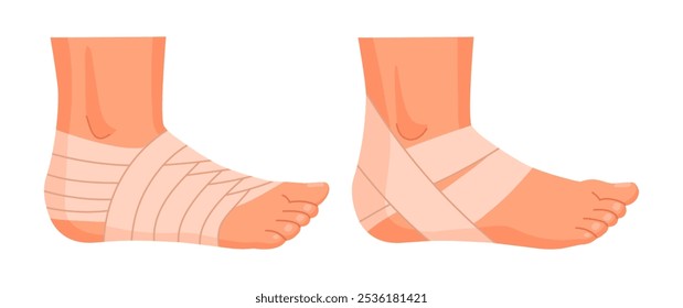 Bandaged human feet. Injured ankles, damaged legs parts, emergency treatment for sprains and bones fractures flat vector illustration set. Physical injury bandages