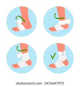 Bandaging scheme. Applying medical bandage or plaster on injured ankle, step by step instructions, trauma fixation, nowaday vector cartoon flat isolated traumatology infographics poster