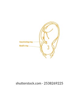 Bandl's ring and constriction ring obstetric drawing vector