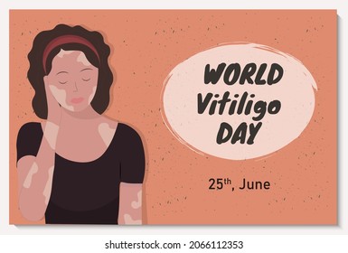 Banner with beautiful young woman with vitiligo desease, flat vector illustration