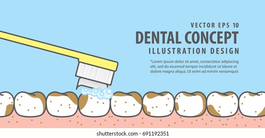 Banner Brushing very dirty teeth and gum illustration vector on blue background. Dental concept.