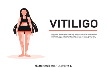 Banner for the clinic for the fight against vitiligo with the image of a girl.