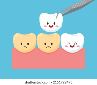 Pancarta con pinzas dentales que reemplazan dientes no sanos con dientes sanos, ilustración vectorial plana aislada en fondo azul. Dientes cortos para la odontología.