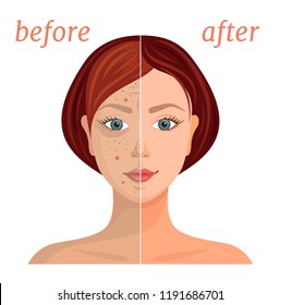 Banner with the image of a woman's face before and after the application of cosmetics. Comparison of problematic dull skin and healthy, clean. Vector illustration.