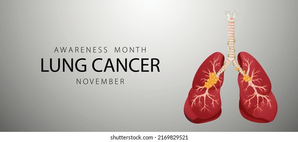 Banner informing about lung cancer. Design template for websites, magazines. Vector illustration cartoon style.