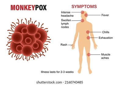 A banner with the monkey pox virus to inform and warn. Symptoms of the monkey virus. Vector illustration