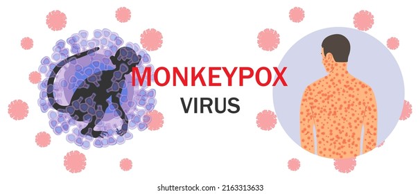 Banner with monkeypox virus cells, monkey silhouette, text and human body with rash on microbiology background. The concept of a viral disease and its symptoms. Vector illustration.