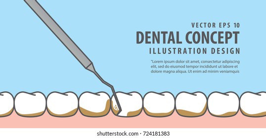 Banner Scaling teeth illustration vector on blue background. Dental concept.