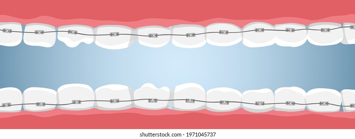 Banner with teeth and braces. Vector illustration in cartoon style