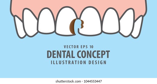 Banner Upper Cavities teeth illustration vector on blue background. Dental concept.