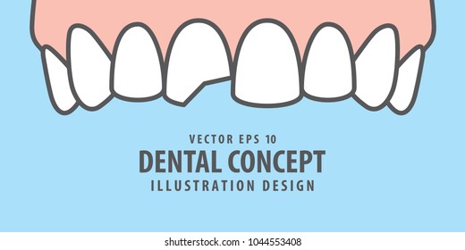 Banner Upper Chipped tooth illustration vector on blue background. Dental concept.