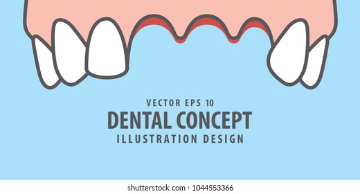 Banner Upper Lost teeth illustration vector on blue background. Dental concept.