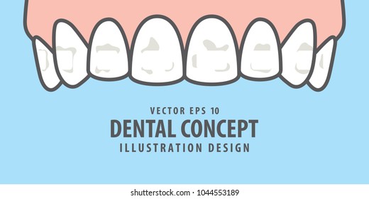 Banner Upper White Spots On Teeth Illustration Vector On Blue Background. Dental Concept.