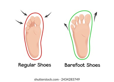 Barefoot shoes care vector illustration infographic. Orthopedic and anatomical shoes. compare healthy and deformity feet.