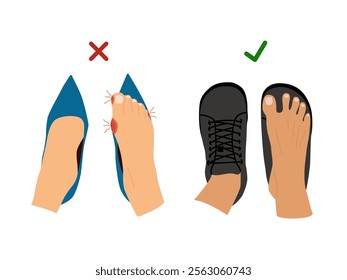 Barefoot Shoes.  Feet with Bunions.  Compare regular narrow shoes and barefoot shoes. Tight shoes and heels lead to problems with the feet, bone deformation, redness and inflammation