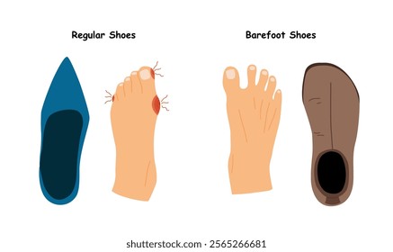 Barefoot Shoes.  Feet with Bunions.  Compare regular narrow shoes and barefoot shoes. Tight shoes and heels lead to problems with the feet, bone deformation, redness and inflammation