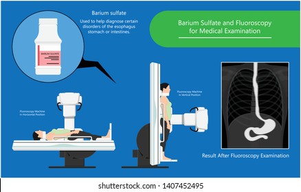 Barium Swallow Study Test Diagnose Barrett's GI Tract Exam GERD Ulcers Series Difficulty Pharynx Procedure UGI Throat Bowel Therapy