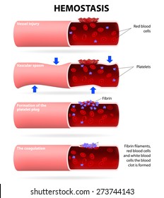 Basic Steps In Hemostasis