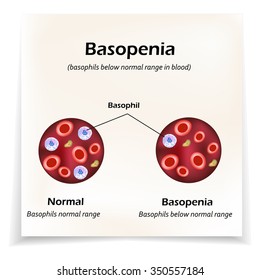 Basophils below the normal range in the blood. Basopenia. Infographics. Vector illustration.