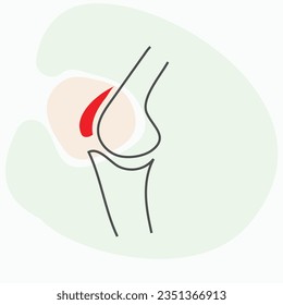 bear weight on your knee depends on the specific injury you have and the recommendations of your healthcare provider
