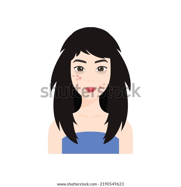 Beautiful Asian Woman with Problem Skin on\
Face. Pimples and Dark Circles Under her Eyes. Japanese Lady with\
Bad Damaged Hair. Unkemptness. Color Cartoon style. White\
background. Vector\
illustration.