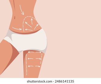 Beautiful athletic figure of a woman with arrows by body zones vector template for design on the theme of body massage plastic surgery medicine