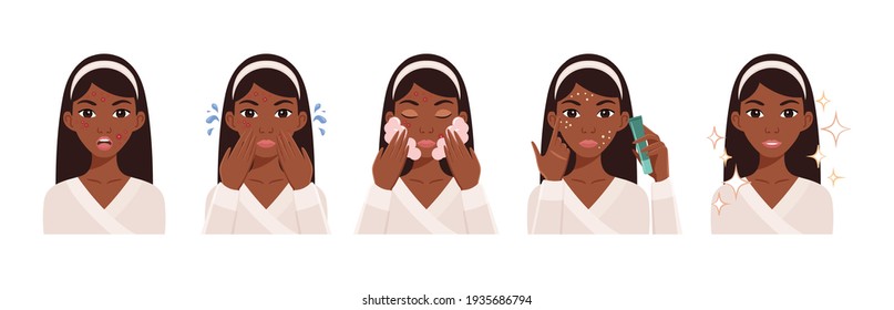 Beautiful black woman with pimples on her face.African American girl treats acne.The lady cleans her face, uses foam and cream. Steps. Flat cartoon style.  White background. Vector stock illustration.