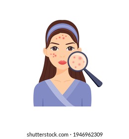 Beautiful Brunette Woman with Problem Skin. Magnifying Glass and Pimples. A Girl with a Head Band, Clothes, Pimples.
 Flat Color Cartoon style. White background. Vector stock illustration.