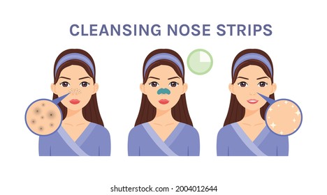 Beautiful Girl with Blackhead on Face. Woman applies a Strip for Dark Dots. Cleansing the Skin and Nose. Before and After. Steps. Flat color Cartoon style. White background. Vector stock Illustration.