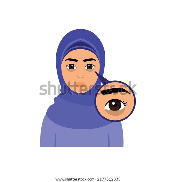 Beautiful Muslim Woman and Dark Circles Under
Eyes. Arab Lady in Hijab and Skin Problem. Zoom. Closeup view.
Color Cartoon style. White background. Vector illustration for
Beauty and Medical
Design.