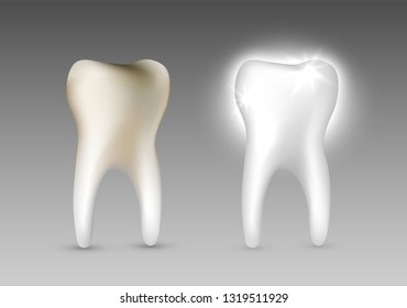 Beautiful realistic dentist vector set of decayed and white shiny tooth on grey background.