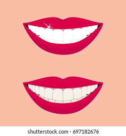 Beautiful smiling mouth with healthy teeth before and after whitening teeth. Design concept. Vector illustration