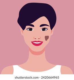 Beautiful smiling young woman with a birthmark on her face. Rare appearance. Portrait or an avatar. Vector illustration