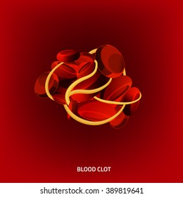 Beautiful Vector Illustration Of A Blood Clot. Abstract Medicine Concept. Useful For Poster, Indographics, Placard, Leaflet, Brochure, Print, Book And Advertisement Graphic Design.