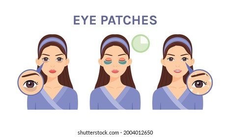 Beautiful Woman and Dark Circles under Eyes. Cute Girl uses Patches for Puffiness, and Skin Problems. Steps. Before, After. Fair skin and Happiness. Flat Cartoon Color style. White background. Vector