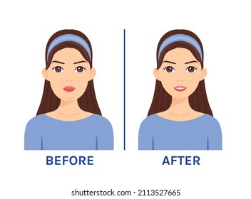 Beautiful Woman With Fat Face. Overweight And Double Chin. Treatment And Surgery. Before After. Happy Slim Lady. Smile On Female Face. Cartoon Style. Vector Illustration For Medical And Beauty Design.