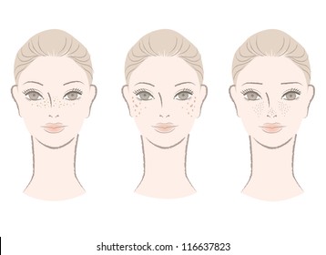 Beautiful woman with freckles, liver spots, large pores. Isolated on white. Cut out. Vector. For other variation, check my portfolio.