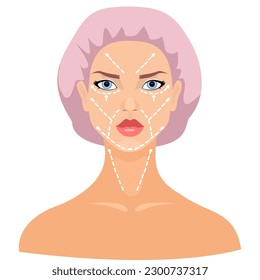 Beautiful woman with marks drawn on her face for plastic cosmetic surgery vector illustration. Plastic surgery face isolated on white photo-realistic vector illustration