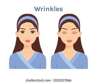 Beautiful Woman with Wrinkles on Face. Portrait of Lady with Folds on Skin. Wrinkle on Forehead, Around the Eyes, Lips. Cartoon style. White background. Illustration for Beauty, Medical Design. Vector