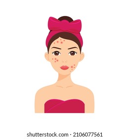 Beautiful Young Woman with Acne and Pimples on Face. Skin Problem. Pretty Brunette Girl in a Towel and with a Bow on Head. Color Cartoon style. White background. Vector illustration for Beauty Design.