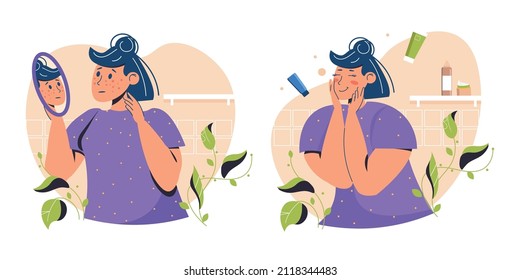 Beautiful Young Woman Girl With Two Different Skin Conditions: Acne, Pimples, Blackheads And Healthy Skin. Skincare And Dermatology. Face Mask, Cream. Teenager Skin. Flat Cartoon Vector Illustration